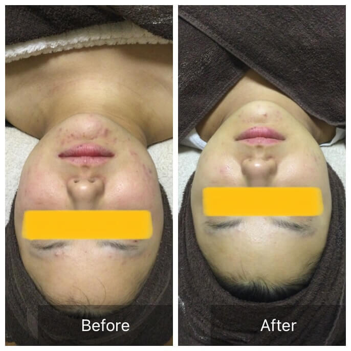 ビフォーアフタ写真1