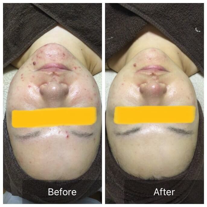 ビフォーアフタ写真2