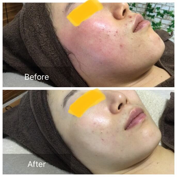 ビフォーアフタ写真4