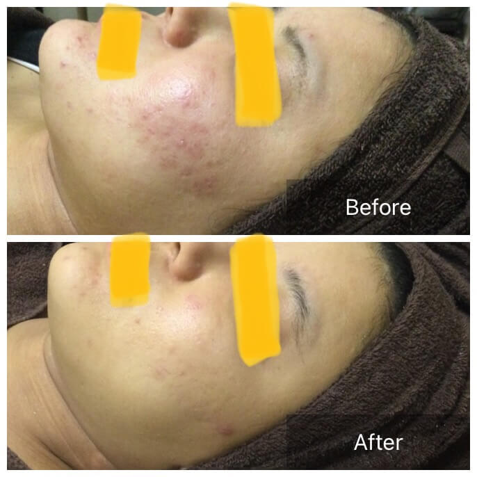 ビフォーアフタ写真5