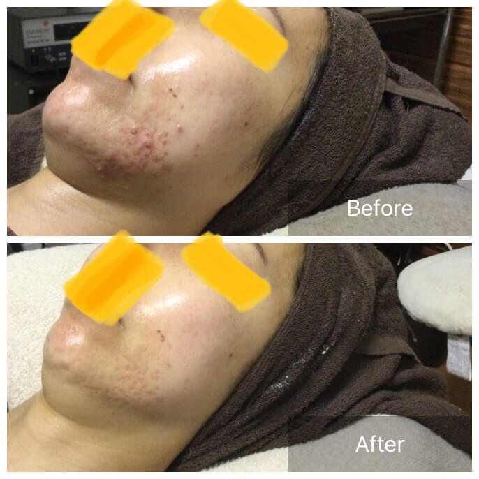 ビフォーアフタ写真6