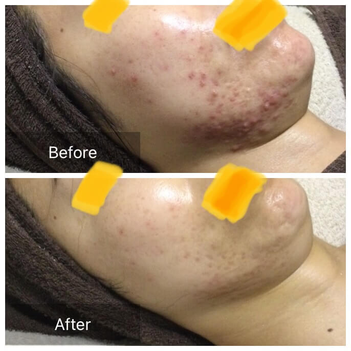 ビフォーアフタ写真3